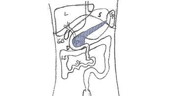 Location of the Pancreas